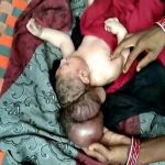 la naissance d’un bébé à 3 têtes fait objet de pèlerinage et de bénédiction